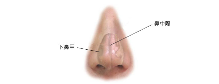 鼻甲骨切除術